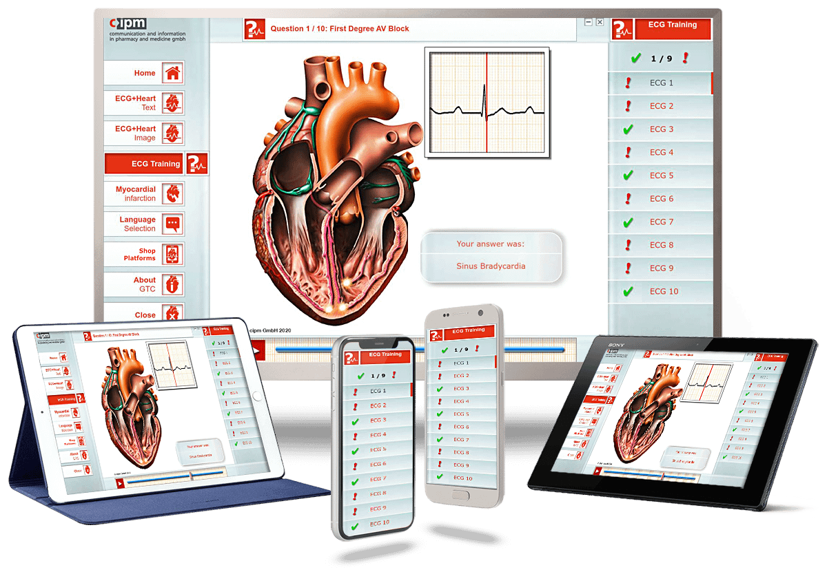 ekg-training-ecginmotion